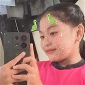 Xe